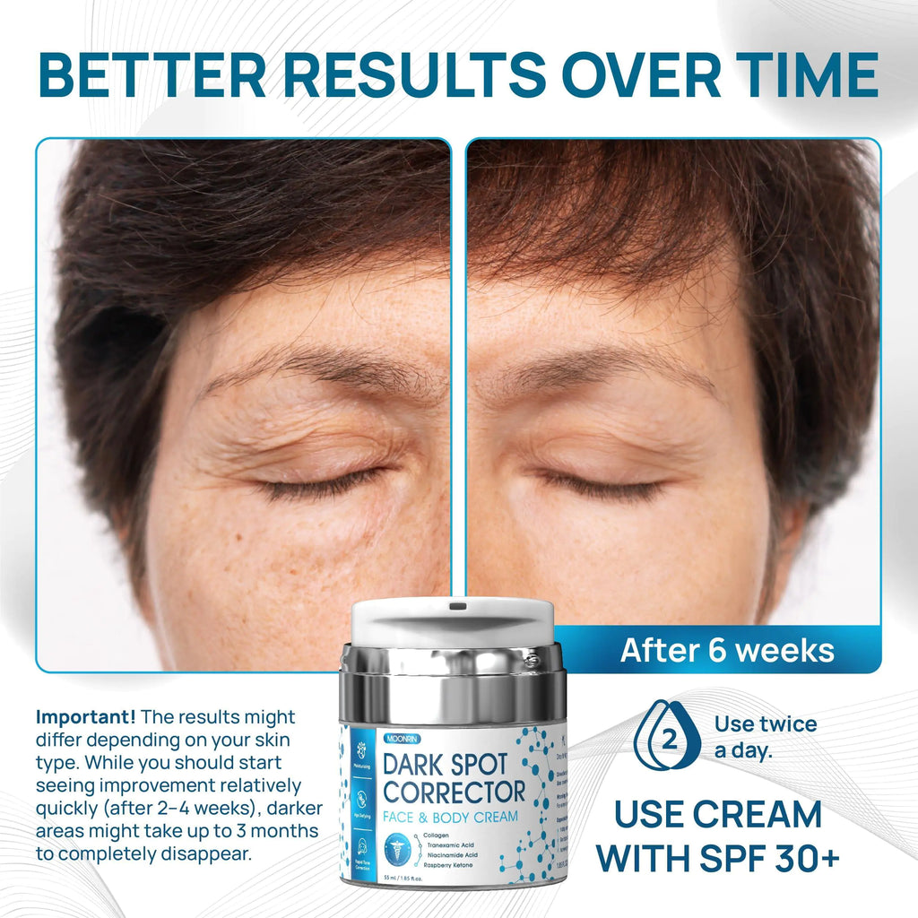 Collagen Dark Spot Corrector